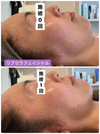 プライベートサロン プリュネルのエステ・リラクイメージ