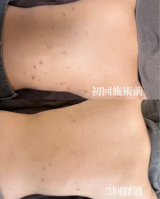 瀧野 史園のエステ・リラクイメージ