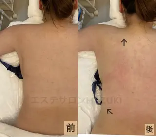 たるみ改善小顔エステ 堀葉月のその他イメージ