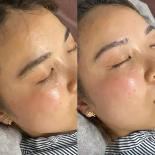 アイブロウ Mr.&Ms.脱毛 NATSUMIのエステ・リラクイメージ