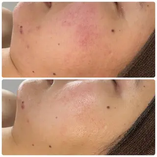 肌育脱毛サロン LikoLinaのその他イメージ