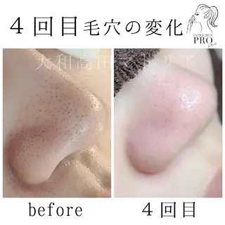 小顔 美肌専門 Matoriaのエステ・リラクイメージ