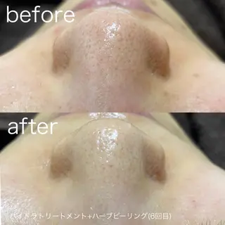 lulularico Yuのエステ・リラクイメージ