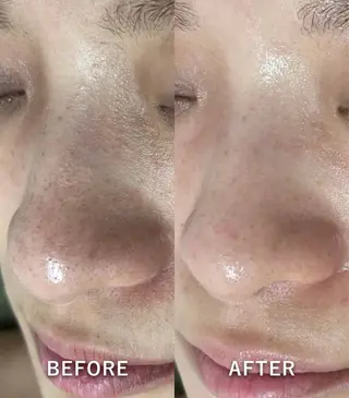 韓国美肌/肌質改善 【天神】のエステ・リラクイメージ