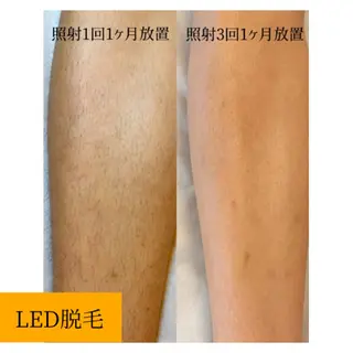 viv　春日部/豊春 megumiのエステ・リラクイメージ