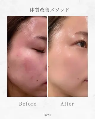 Bevi salonのその他イメージ