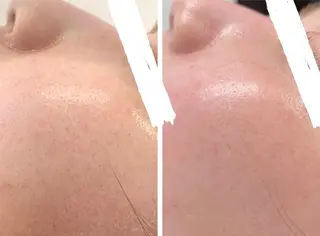 小顔&デコルテ Spa “koti”のエステ・リラクイメージ