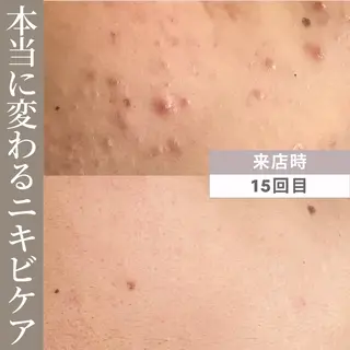 田嶋 雅美のエステ・リラクイメージ