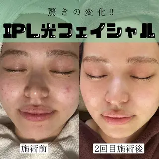 Rafre【ラフレ】 タカヤマのマツエク・マツパデザイン