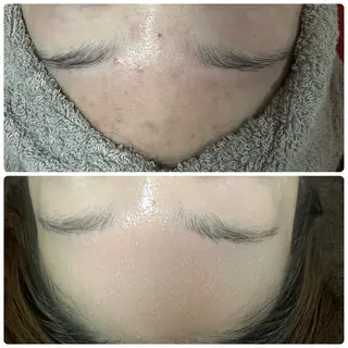 ニキビ毛穴専門店Beautysalon Luana所属・小林 まいのエステ・リラクイメージ