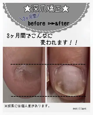 ネイル nail salon petillantのネイルデザイン