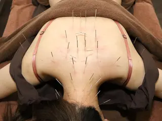 Spring鍼灸院 ✨首肩こり、腰痛に！のその他イメージ