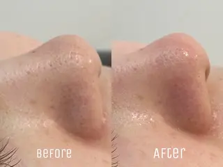 ニキビ・毛穴・肌荒れ &me 西宮北口店のその他イメージ