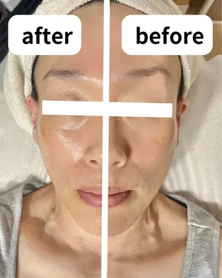 都度払い脱毛サロン Haleのエステ・リラクイメージ