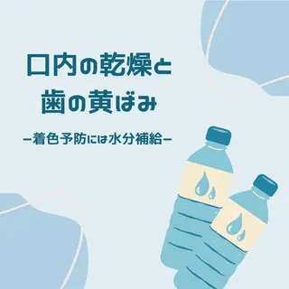 歯のホワイトニング HARU南浦和のその他イメージ