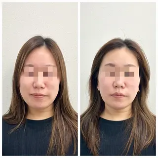 鍼灸HARIKARA所属・鍼灸 ハリカラのエステ・リラクイメージ