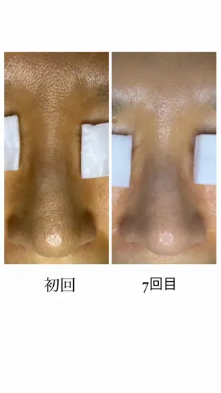 肌改善・リンパサロン CoCoxiaのエステ・リラクイメージ