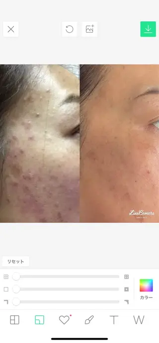 フェイシャルワックス 自然派エステファーノのその他イメージ