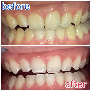 セルフホワイトニング 五反田のその他イメージ