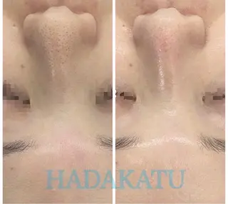 総合エステサロン 肌活のエステ・リラクイメージ