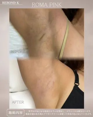 REBOND K モデル募集のマツエク・マツパデザイン