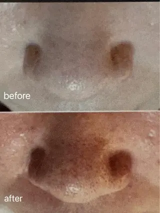 M.rose エムローズのエステ・リラクイメージ