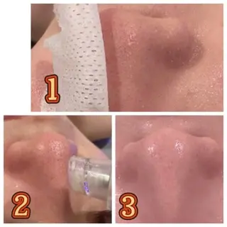 痩身・小顔・脱毛・ オイル&Amourのその他イメージ