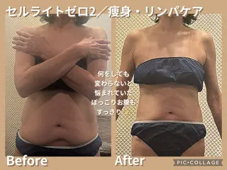 Bodyリカバリー栗山整骨院所属・Arisa｜阪神西宮 肩こり腰痛リンパ痩身のエステ・リラクイメージ