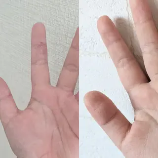 結果が出るスキンケア 肌質改善/まつパのエステ・リラクイメージ