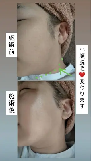 km retreat mentのエステ・リラクイメージ