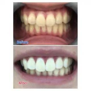 Ｍ渋谷 ホワイトニングのエステ・リラクイメージ