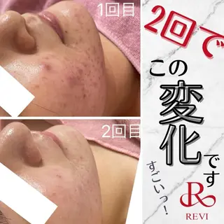 Ange -viva la vida-所属・Ange vivalavidaのエステ・リラクイメージ