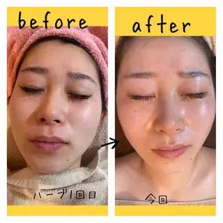 fairyrose organicエステのエステ・リラクイメージ