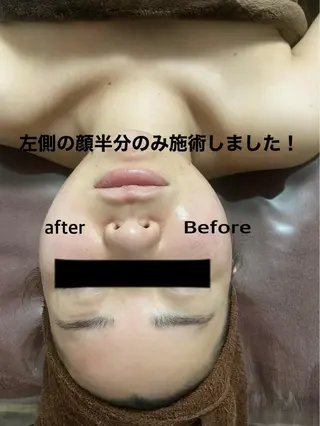 Plumeria （プルメリア）川口のエステ・リラクイメージ