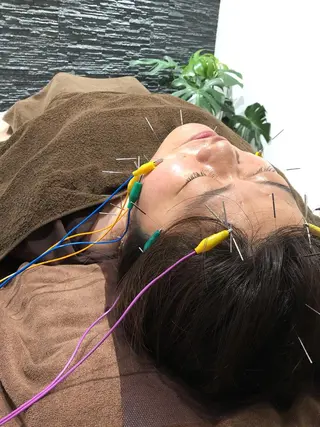 小顔矯/美容鍼/鍼灸 BeauJuのその他イメージ