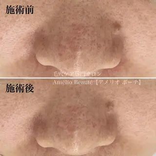 毛穴ケア専門サロン アメリオボーテのその他イメージ