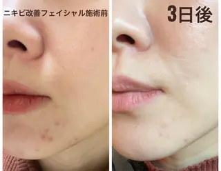 COCO beautyサロンのエステ・リラクイメージ