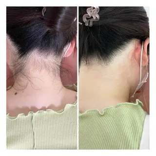 美肌脱毛サロンGrande所属・別府脱毛サロン Grandeのエステ・リラクイメージ