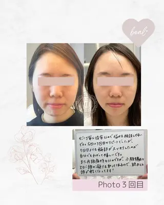 小顔/毛穴/ニキビ salon bealのエステ・リラクイメージ