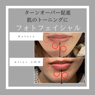 脱毛サロン Lokahiのエステ・リラクイメージ
