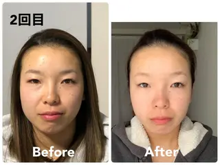 小顔矯正サロン スターローズのエステ・リラクイメージ