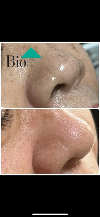 SALON BioBioのエステ・リラクイメージ