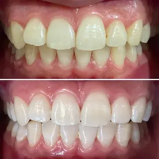 カラー ネイル マツエク・マツパ ホワイトニングサロン CREWのその他イメージ