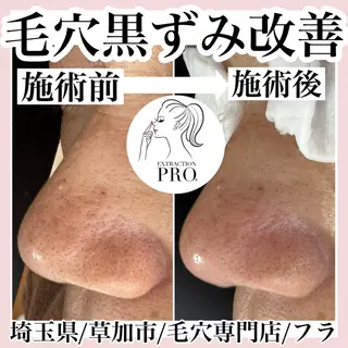 毛穴専門店hula 杉山智美のエステ・リラクイメージ