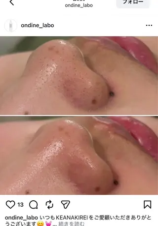 A"-HILU （アーヒル)のエステ・リラクイメージ