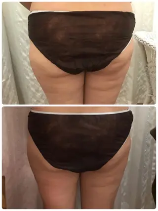 Aloha Mana 草加Ohana店のエステ・リラクイメージ