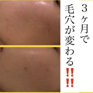 ミディアム カラー パーマ ヘアアレンジ メンズ キッズ マツエク・マツパ ニキビ・肌質改善専門 ♡人生が変わるサロンのエステ・リラクイメージ