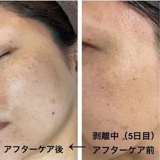 Biestora 郡山店/橋本のエステ・リラクイメージ