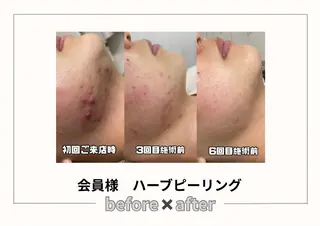 みんなの脱毛ツルリン ☀️船橋店☀️のエステ・リラクイメージ