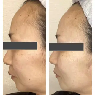 moe sayuriのエステ・リラクイメージ